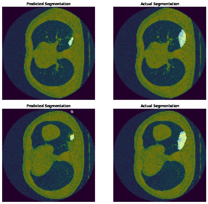Predicted and expert-annotated COVID-19 infection regions side by side for two CT slices