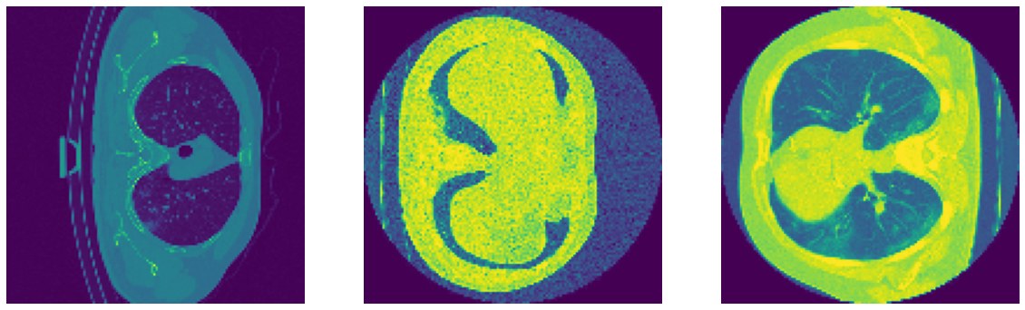 Three CT slices from different sources with different contrast and framing