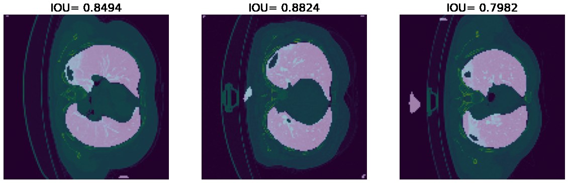Three validation CT slices with the predicted lung mask overlaid and their IoU scores